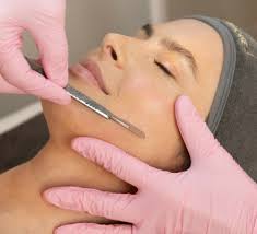 Woman receiving dermaplaning treatment